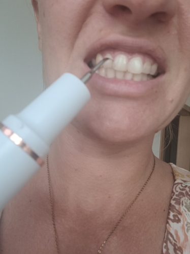 Click to view full screen Watersonic Ultrasonic Tooth Cleaner with Water Cooling photo review